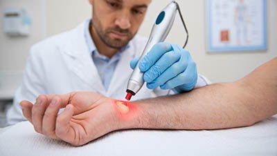 Процедура лазерного кодирования Мужчина делает процедуру лазерного кодирования